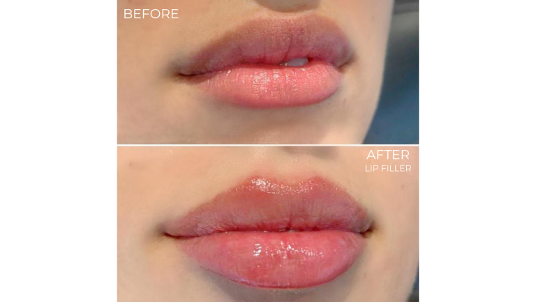 face-boutique-before-after-1