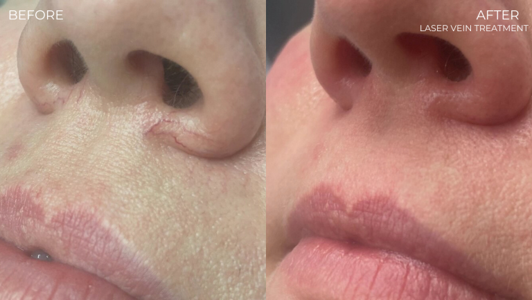 face-boutique-before-after-10