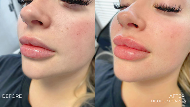 face-boutique-before-after-11