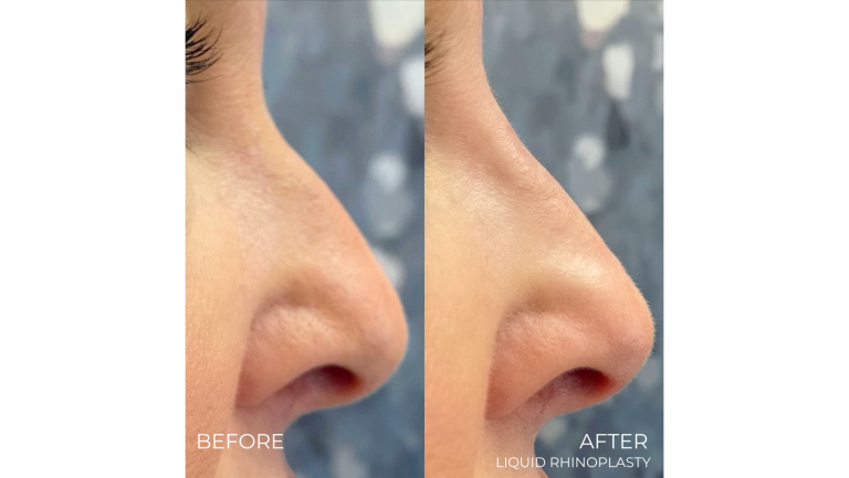 face-boutique-before-after-12