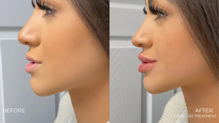 face-boutique-before-after-15