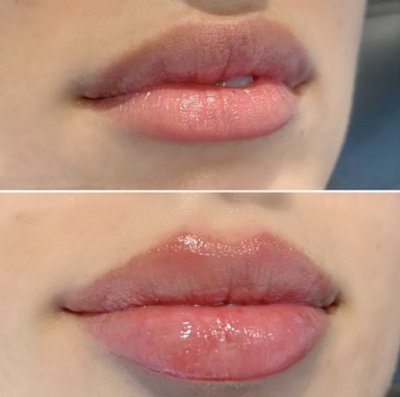 face-boutique-before-after-17