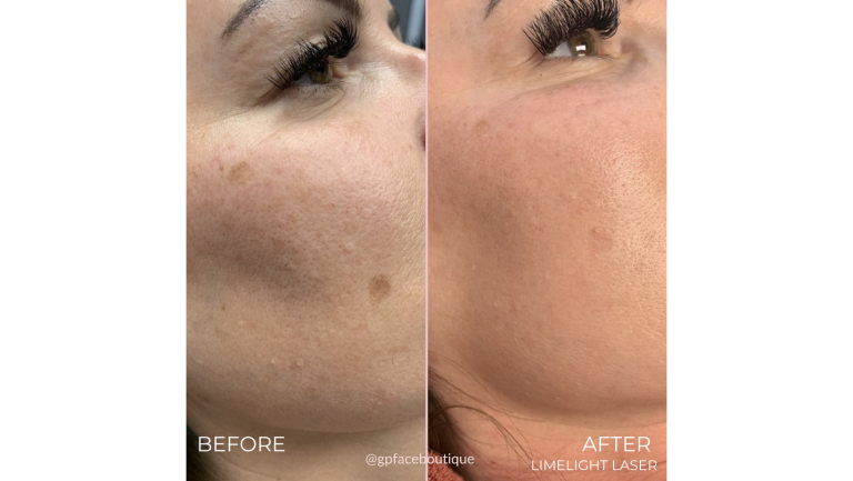 face-boutique-before-after-3