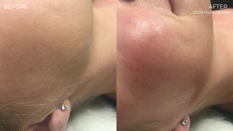 face-boutique-before-after-5