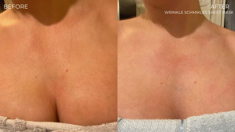 face-boutique-before-after-6
