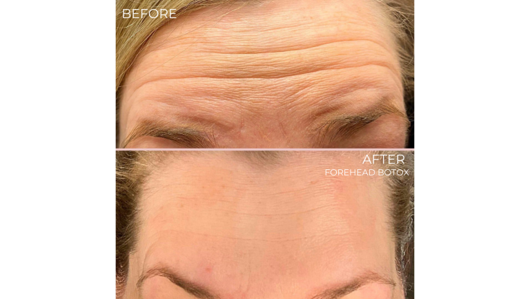 face-boutique-before-after-7