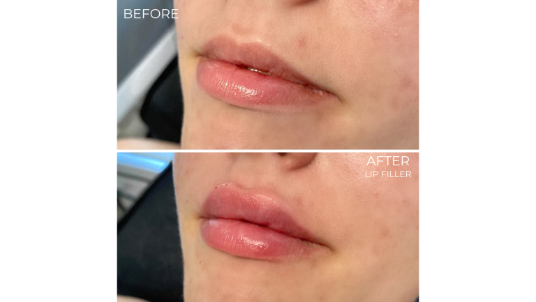 face-boutique-before-after-8