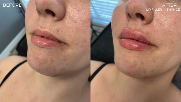 face-boutique-before-after-9
